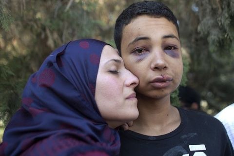 Palestinian Boy (Battered By Isreali Soilders) Palestinian American he is