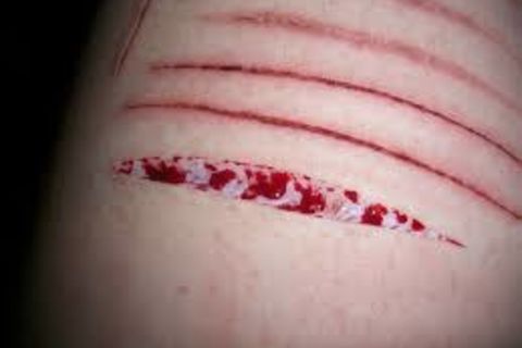 My Pain