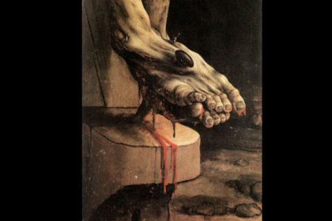 On Wretchedness