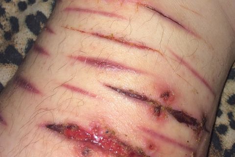 Scars Are What They Are