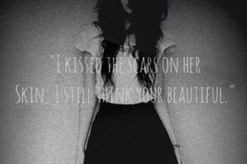 Kiss her scars away