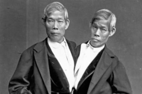 As a conjoined twin