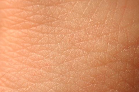 My skin