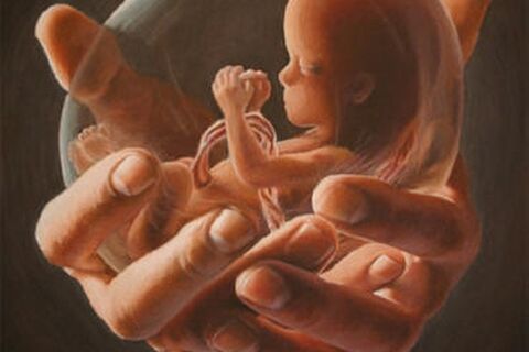 Birth of a Dream