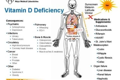 Lacking Vitamin D! (in the uk)