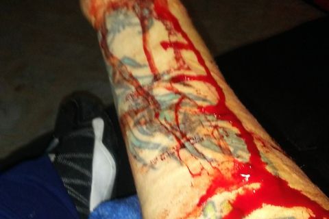 Hi my name is heather,  and I'm a cutter.. 
