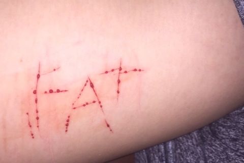 F.A.T.
