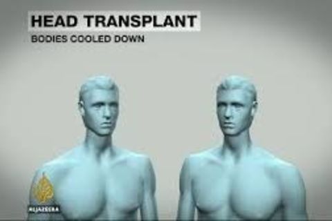 I Wanna Head Transplant