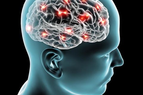 A Cerebral Issue