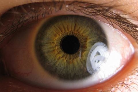 Sight and Blindness