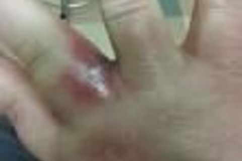Splinter Within