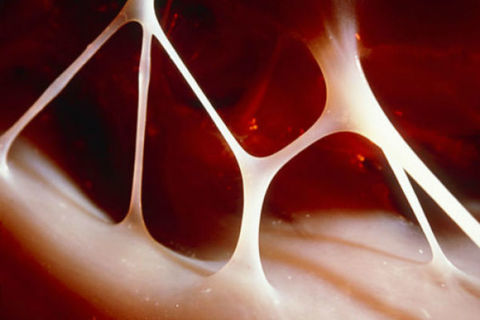 Heart BrAche 