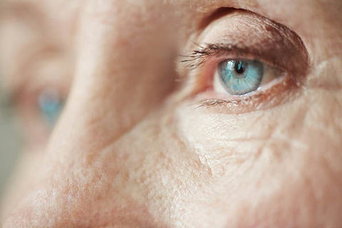 These eyes