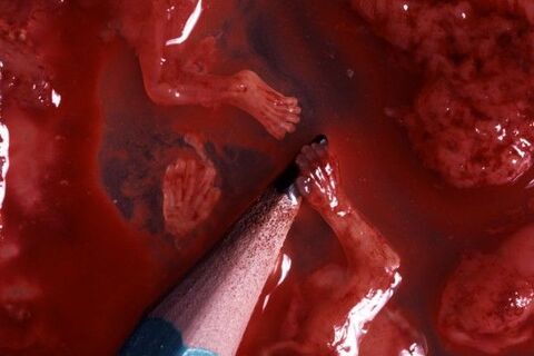 Abortion 