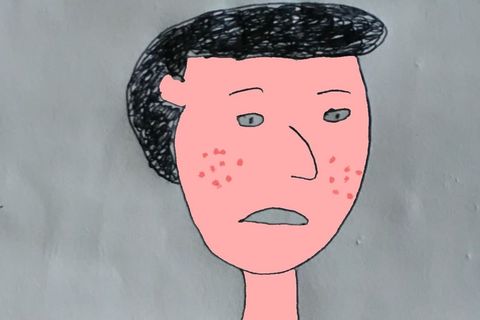 The Red Dots On His Face
