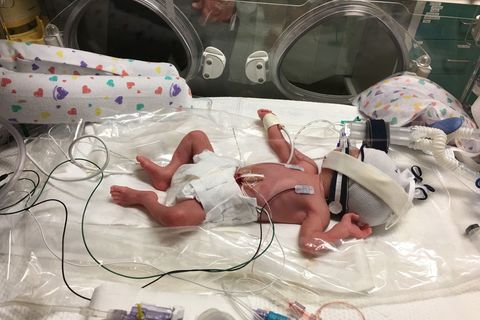 NICU