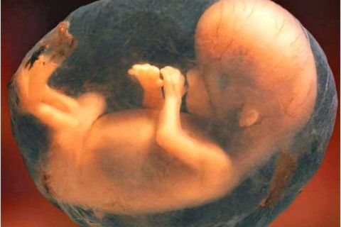 Unborn Child 2