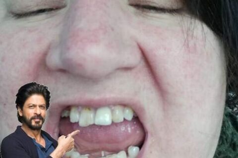 Test icles