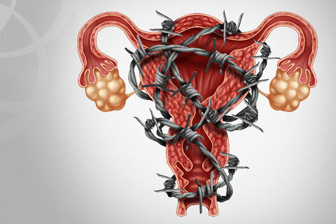 Venting- Endometriosis pain