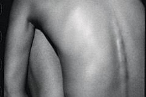 Naked Truth 