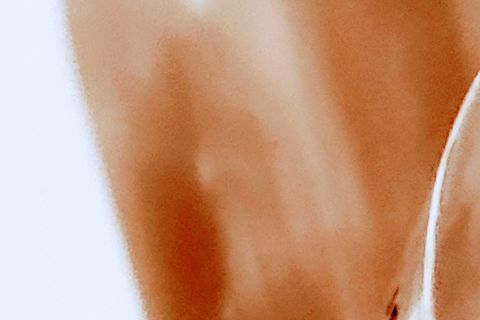 Hits retarded uncon ed