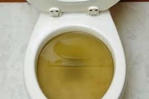 Defecation clogged toilet bowl...