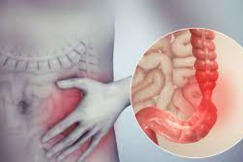 Fraught With IBS Irritable Bowel Syndrome...