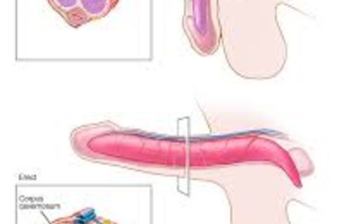 Pendulous predilection per procreative proboscis
