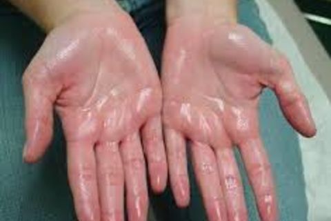 No matter I got prescribed Glycopyrrolate 2 mg tablets taken four times a day...,