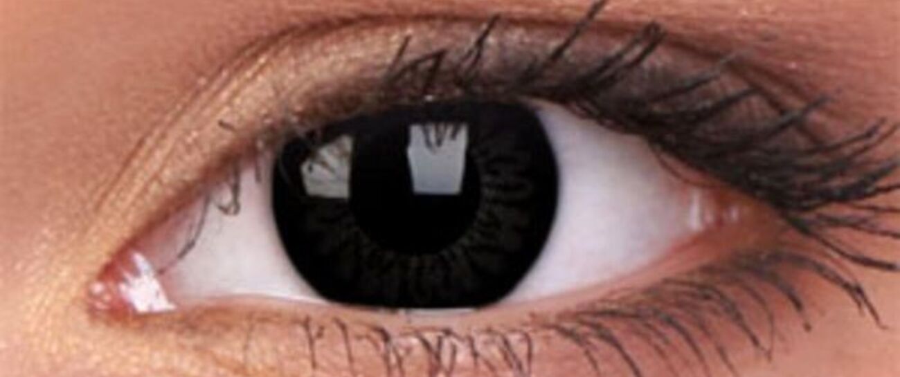 Black Eye