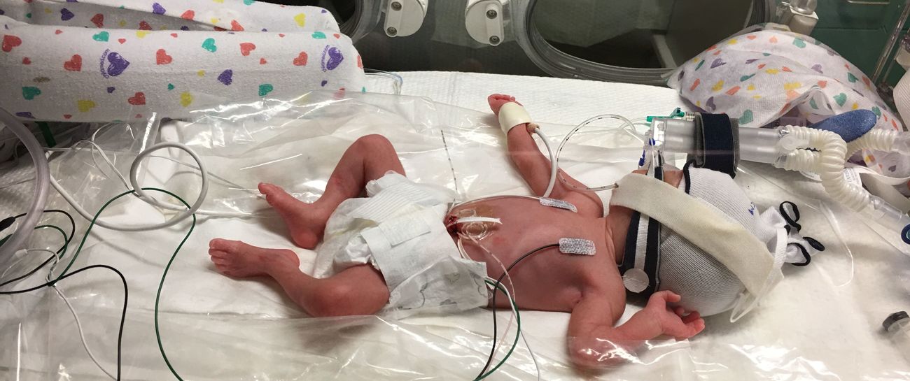 NICU