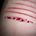 My Pain