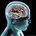 A Cerebral Issue